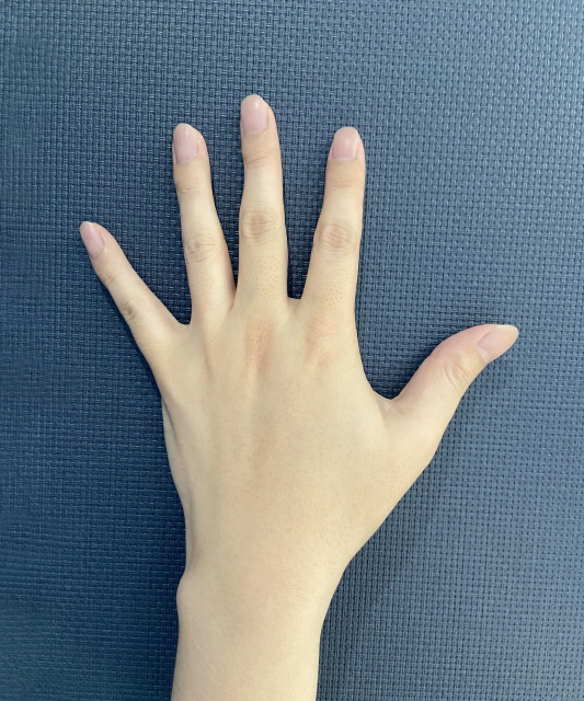 手の指甲脱毛の痛みや脱毛までの回数は？