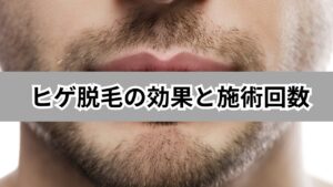 ヒゲ脱毛の効果と施術回数の完全ガイド：1回目から7回目までの変化と最適な間隔を徹底解説