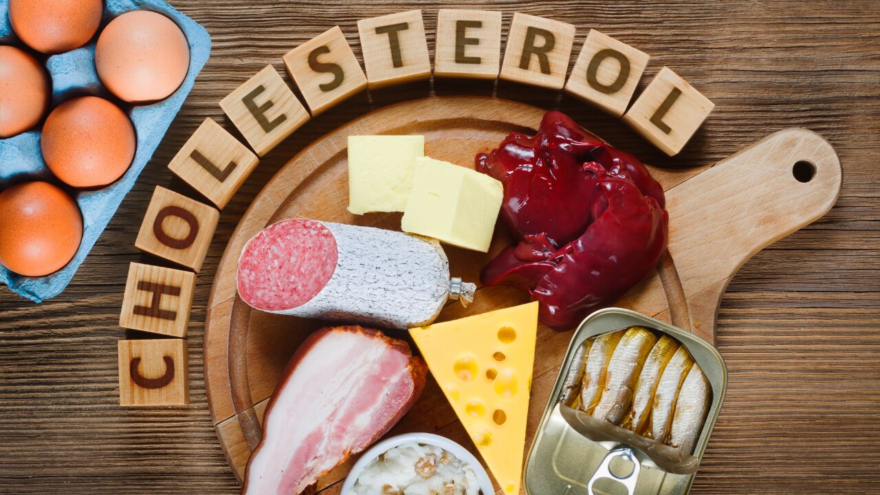 ✅ コレステロールが高い食べ物一覧