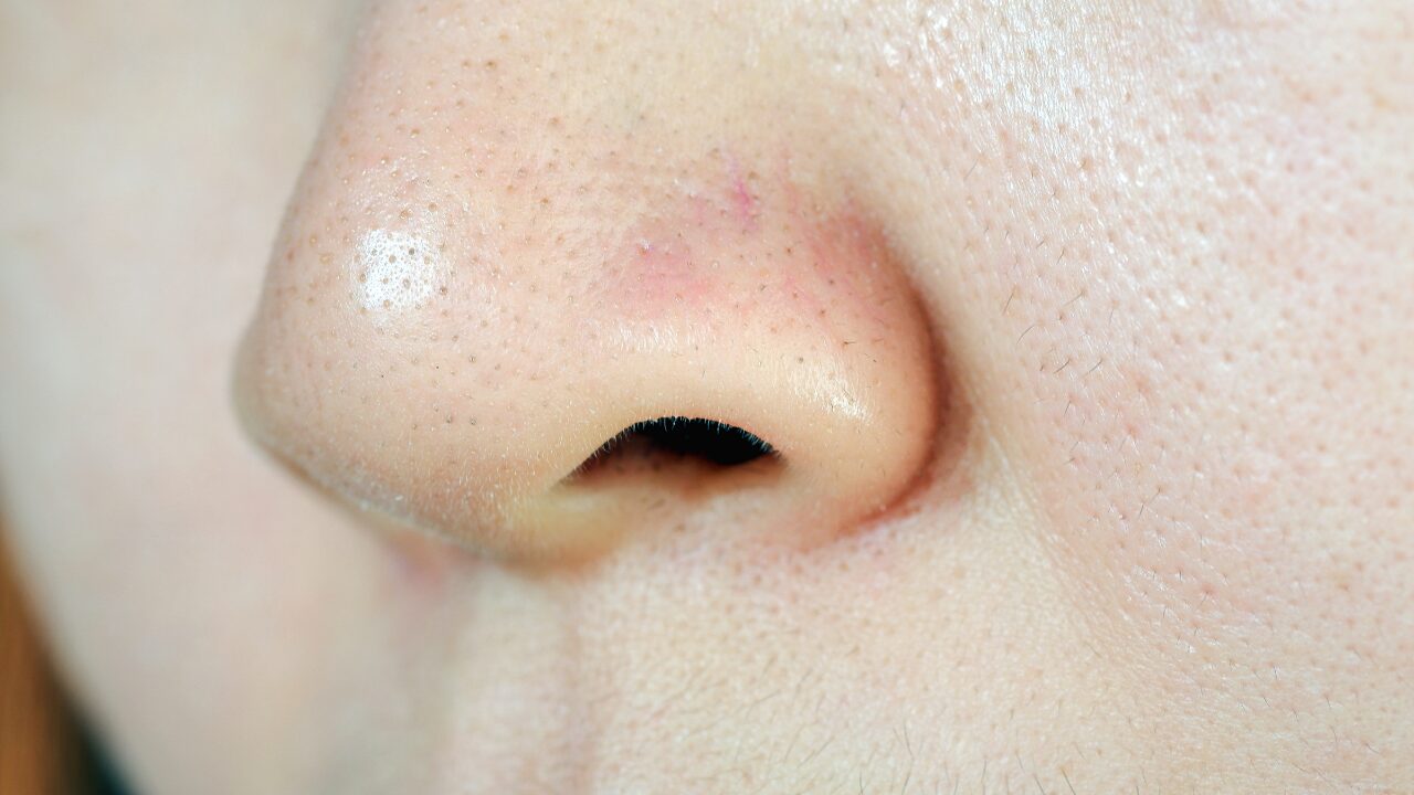 鼻の下だけテカる原因とは？皮脂を抑えるスキンケア術と生活習慣のコツ