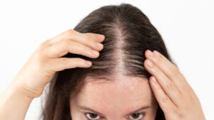 髪の分け目が薄くなってきた…今すぐできる対策法5選