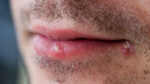 【医師監修】ヒゲを剃る最適な時間帯はいつ？肌を傷めない正しいシェービング法とは