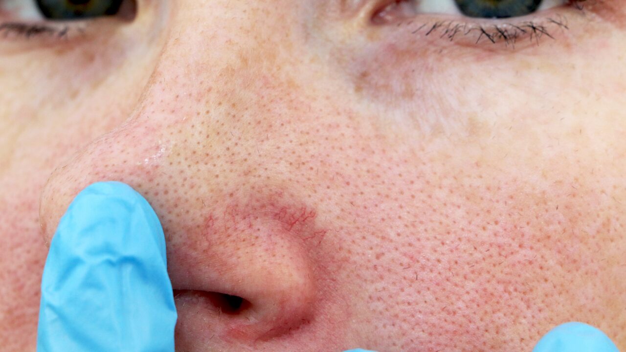 まとめ｜夏の毛穴対策は「継続」と「正しい知識」がカギ！