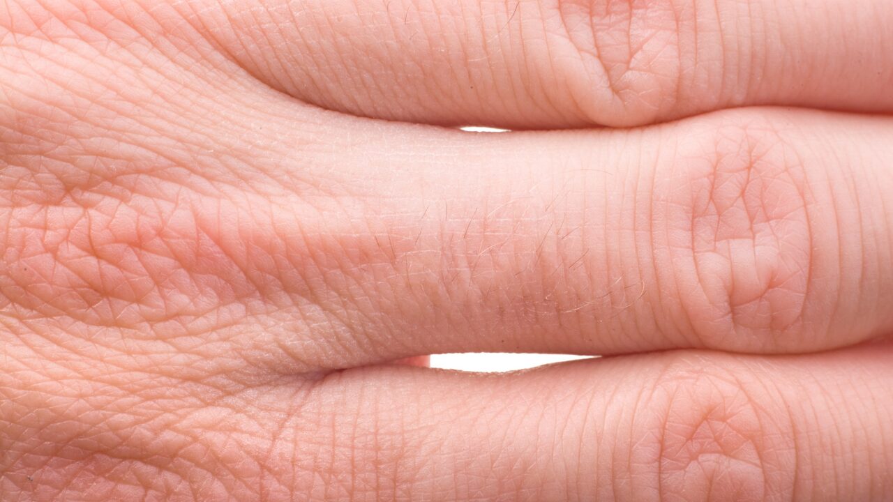 指の関節を鳴らすクセは危険？