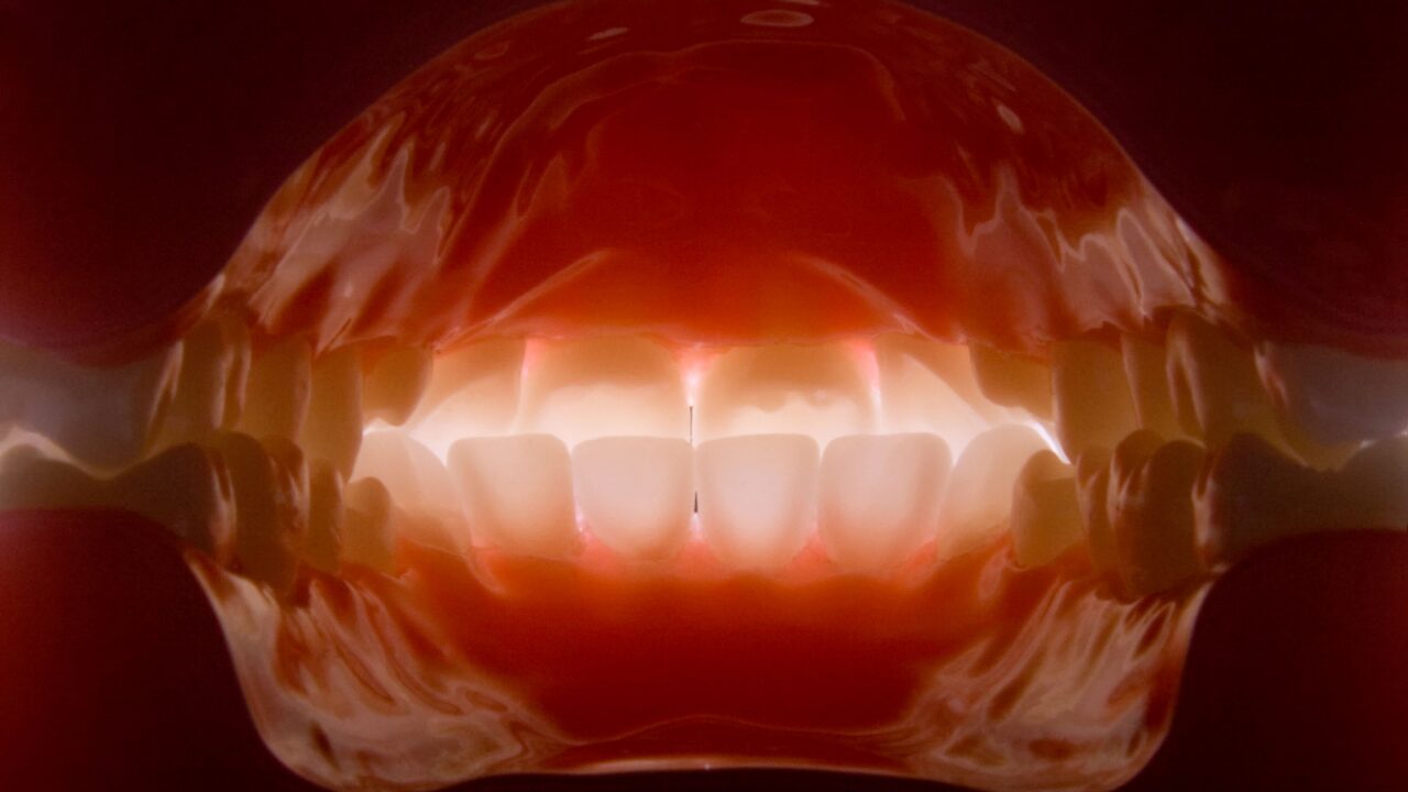 ✅ 口の端が繰り返し切れるときは病気のサインかも？
