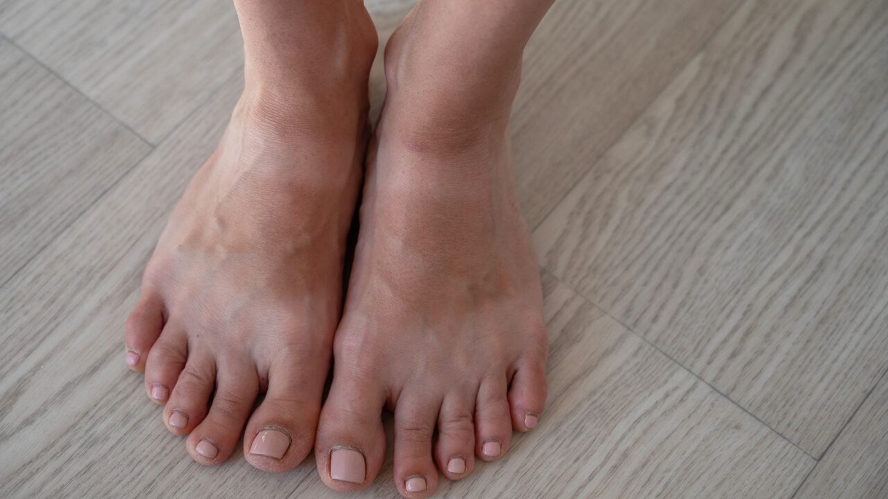 日焼け跡が残りやすい人の特徴と注意点