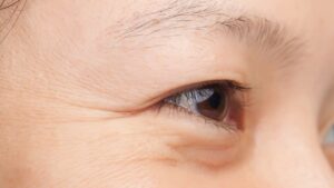 目元の小ジワに効くマッサージ方法5選｜自宅で簡単にできるエイジングケア術