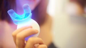 【ビフォーアフター公開】自宅用ホワイトニングキットを1ヶ月使ってみた結果がすごい！本音レビュー付き