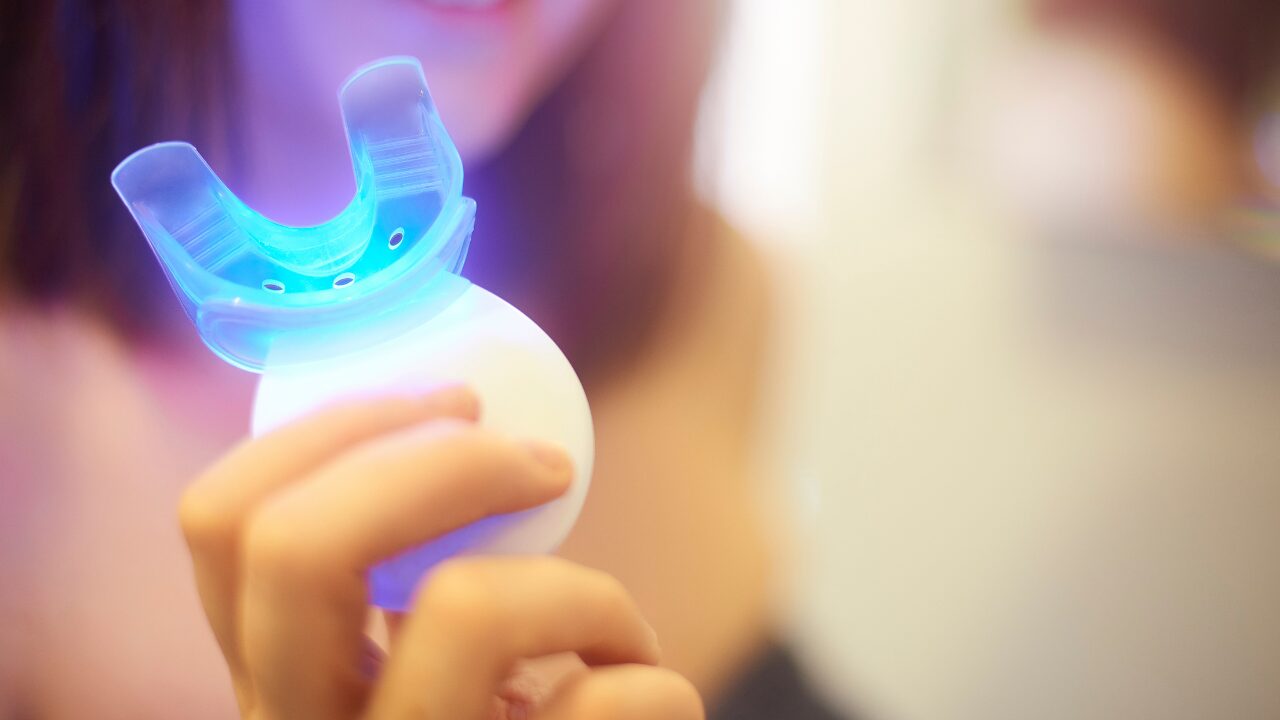 【ビフォーアフター公開】自宅用ホワイトニングキットを1ヶ月使ってみた結果がすごい！本音レビュー付き
