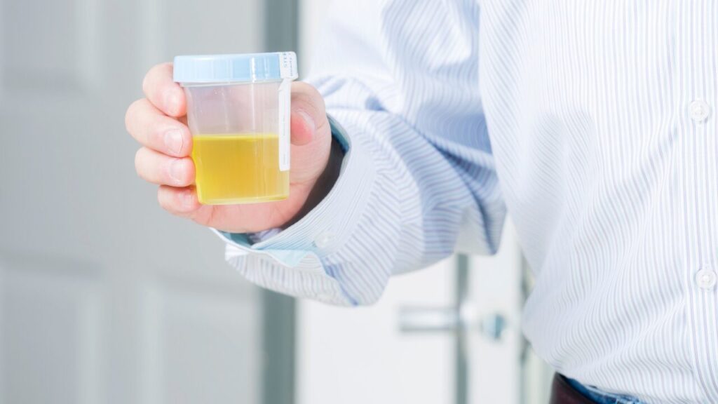 「尿のにおいが変わった…？」その原因、食生活かも。見直したいポイントをわかりやすく解説