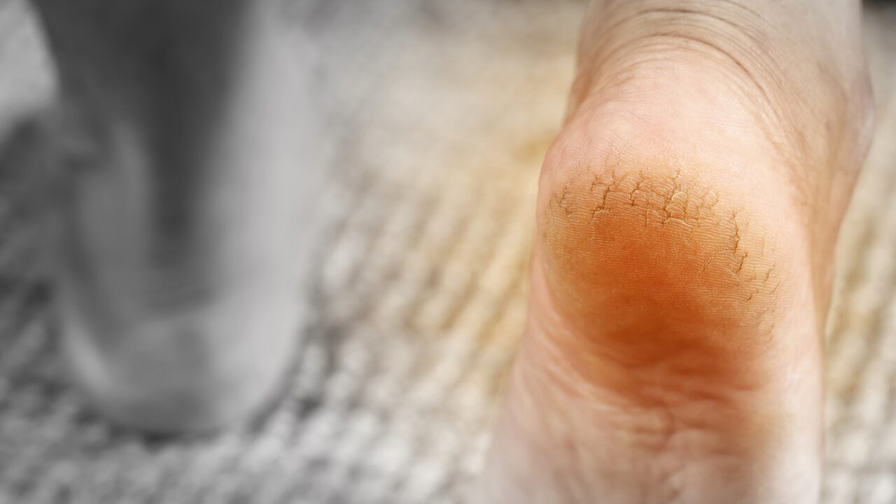 クリームの効果を最大化する使い方