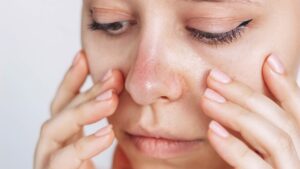 小鼻の赤みがなかなか治らない…原因は生活習慣とスキンケアにあった！見直しポイントを徹底解説