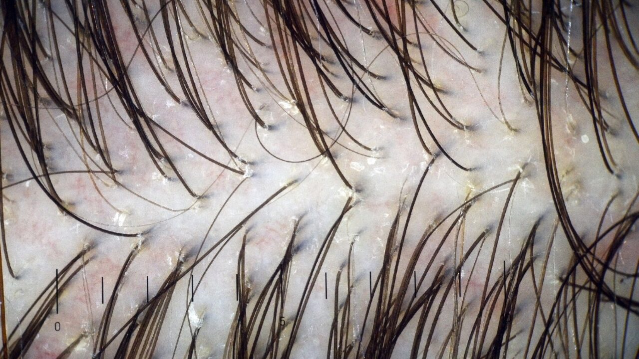 分け目が薄く見えるときの“応急処置”