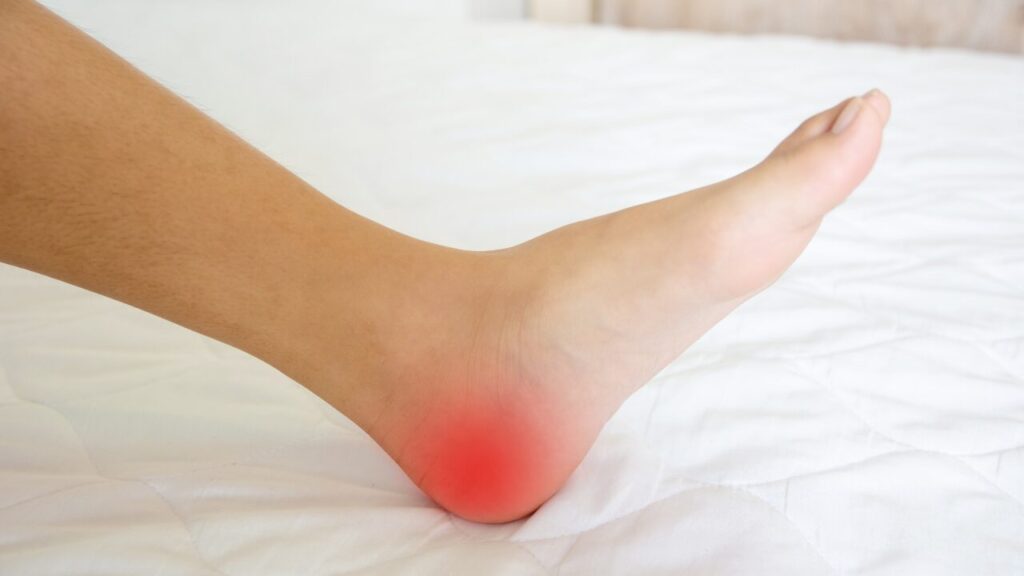 かかとが朝だけ痛い…それ、足底筋膜炎の初期症状かも？原因と今すぐできる対策ガイド