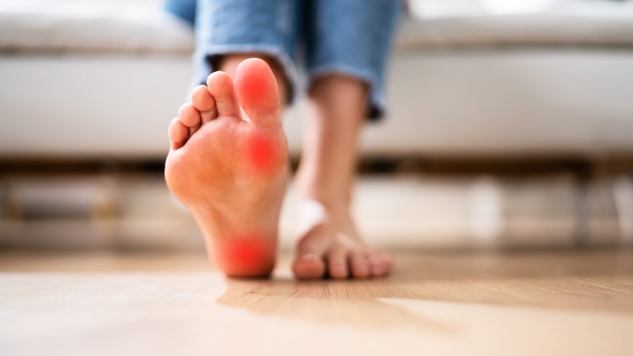 足底筋膜炎とは？症状・原因・なりやすい人の特徴