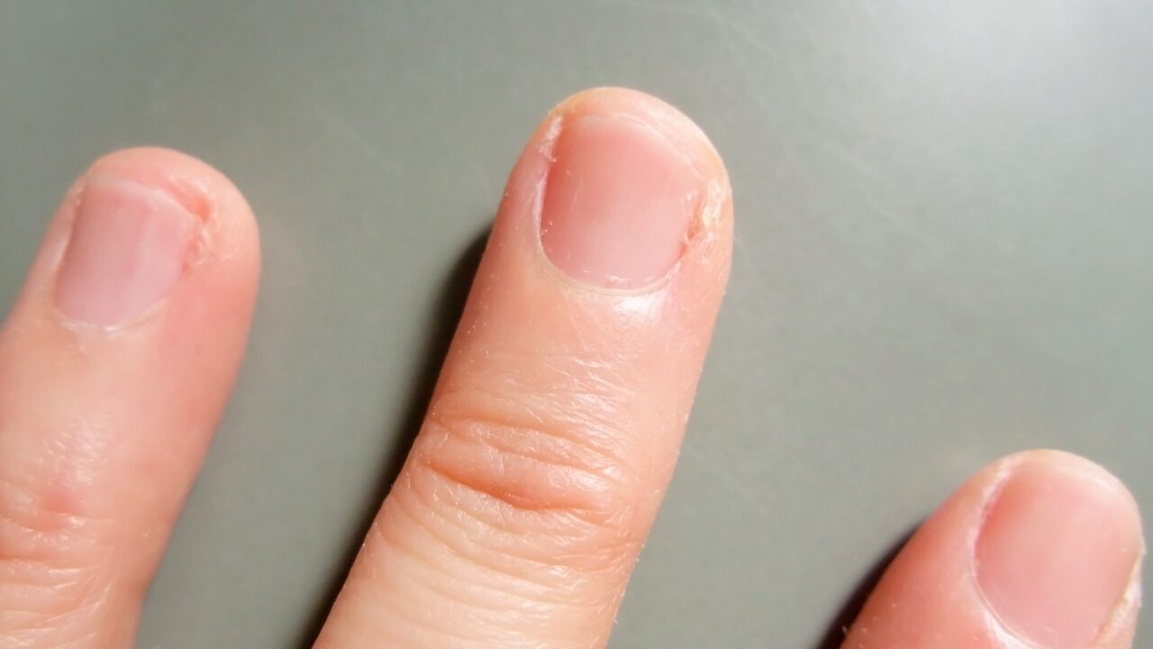 効果的な使い方｜オイルを使ったささくれ予防の手順