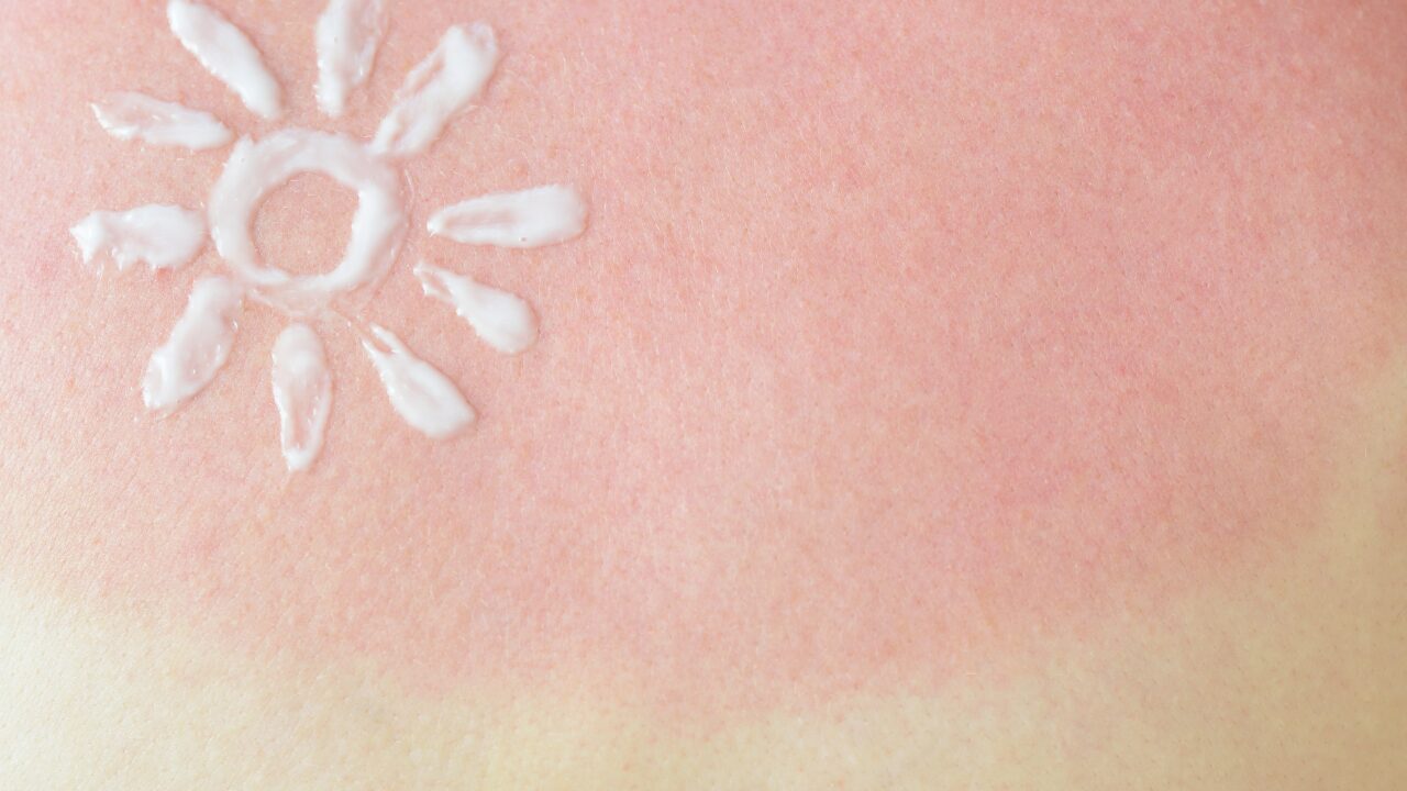 足の甲をきれいに保つ！日常の工夫とアイテム