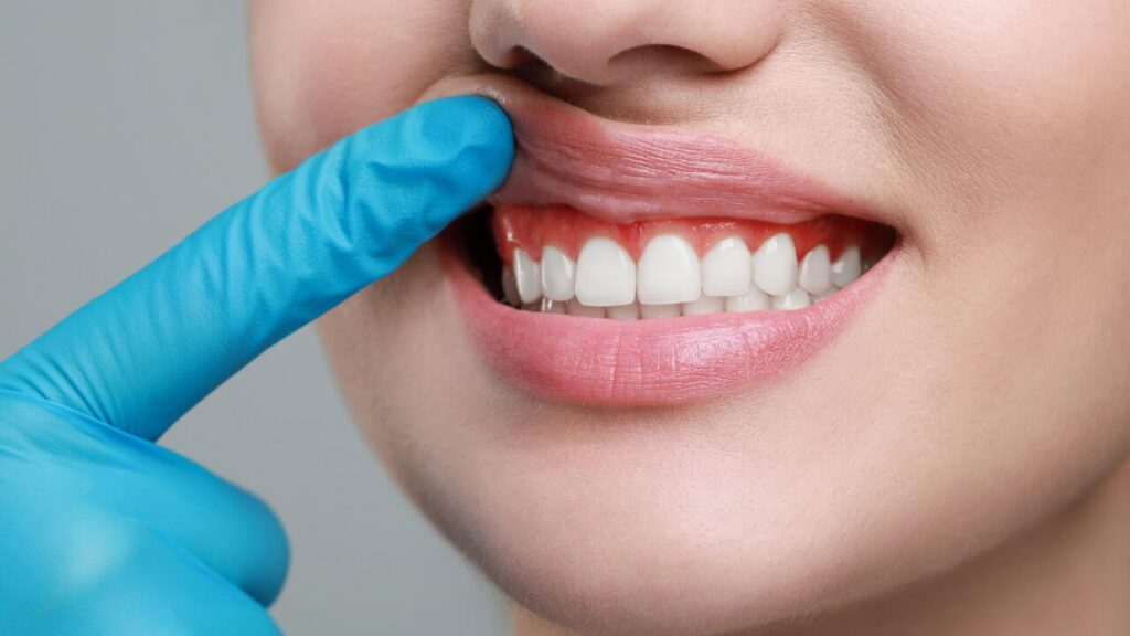 歯茎マッサージのやり方｜健康な歯茎を保つ正しいセルフケア法とは？