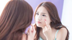 寝不足による肌荒れを改善する方法｜ぐっすり睡眠×正しいスキンケアがカギ！