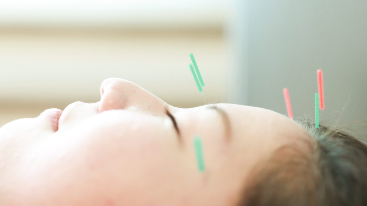 セルフ美容鍼の安全な使い方ガイド