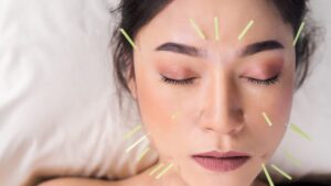 自宅でできる美容鍼の方法｜初心者でも安心の針の選び方＆安全ガイド