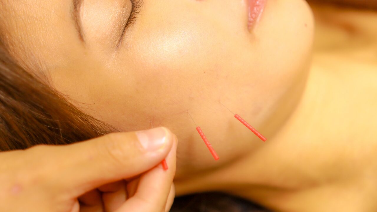 まとめ|自宅美容鍼は正しく使えば、確かな味方に