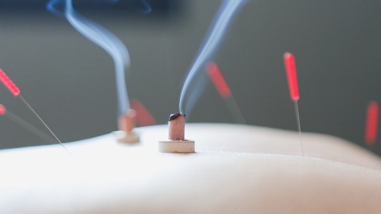 自宅で使える美容鍼の種類と選び方