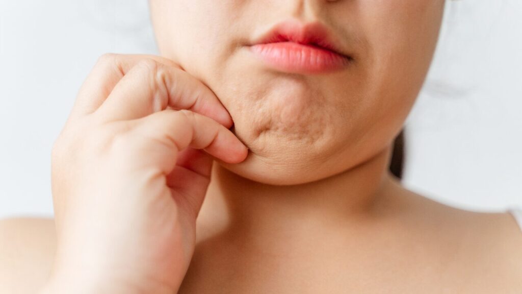 朝の顔パンパンを治す方法｜むくみ解消ストレッチ＆習慣を紹介