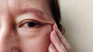 まぶたのたるみ改善クリーム｜塗り方と成分で差がつく！【目元年齢-5歳】