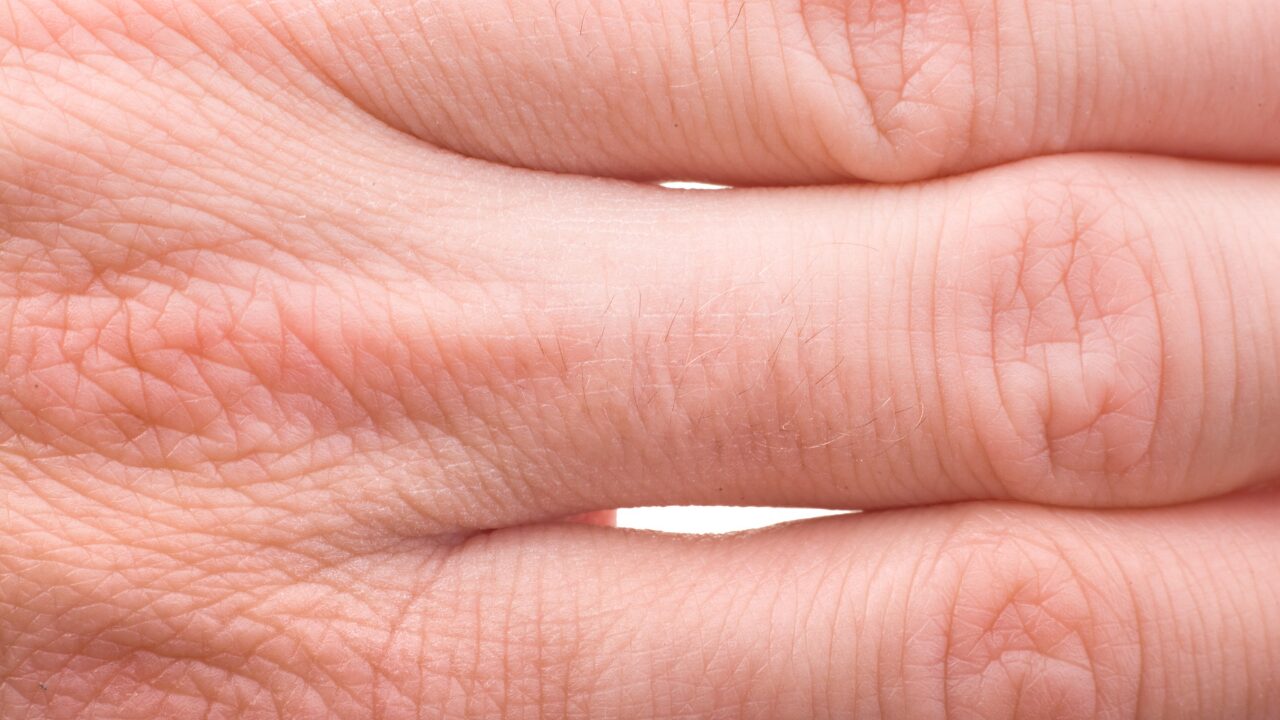 まとめ｜指の関節は“ケアと魅せ方”で変えられる！