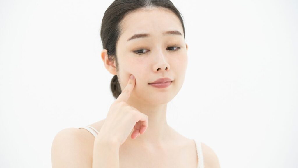 生理前の肌荒れにピーリングはOK？肌を傷めない正しいタイミングとケア方法