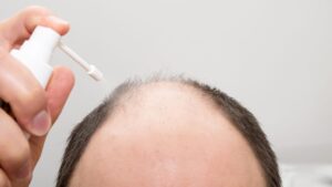 【比較】育毛剤おすすめランキング｜成分・価格・使用感で徹底レビュー！