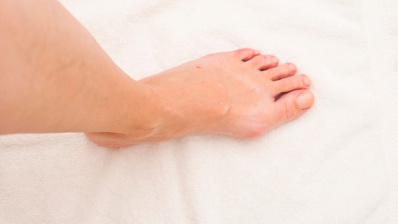 色素沈着を防ぐ！足の甲の“美白ケア”のコツ