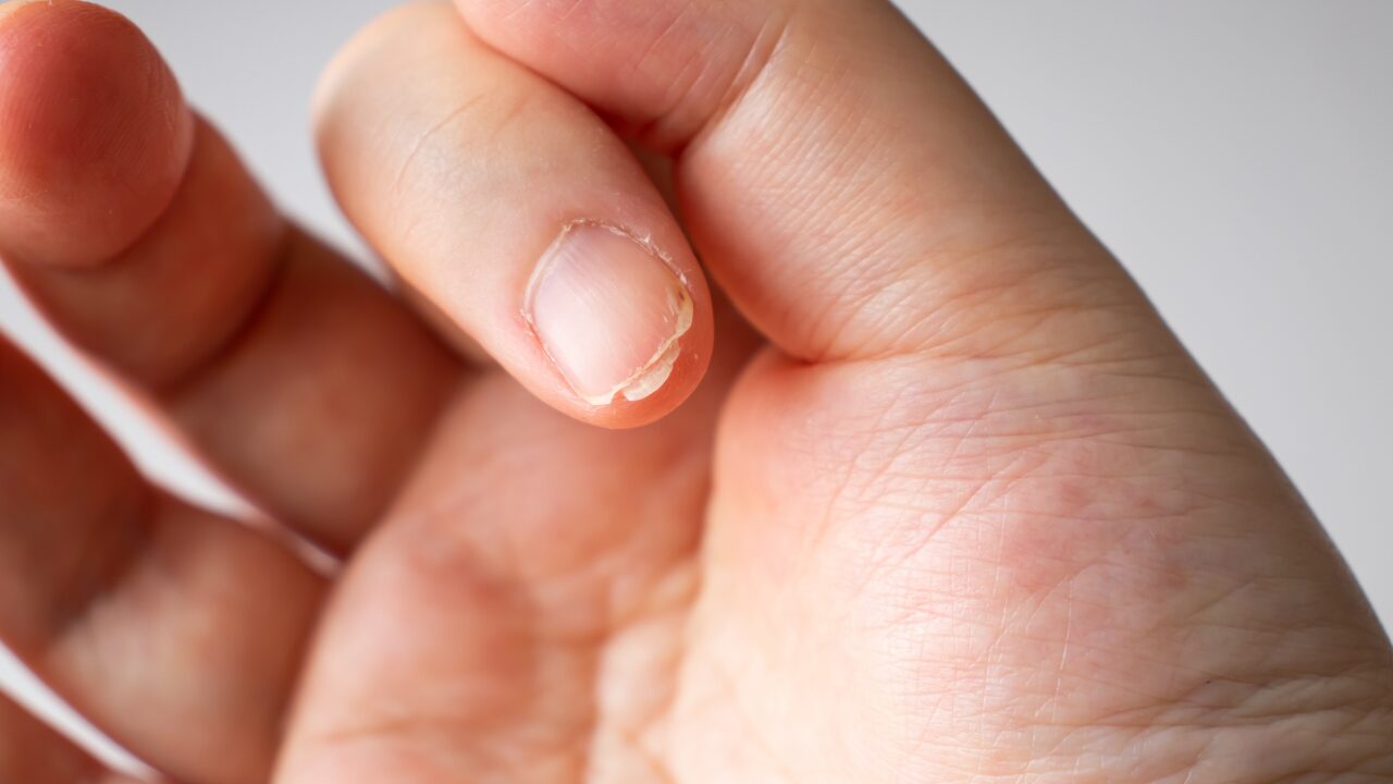 あわせて見直したい！二枚爪を防ぐ生活習慣