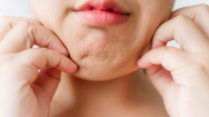 【顔のもたつき解消】あご下のむくみが取れない原因と効果的な小顔ケアの基本とは？