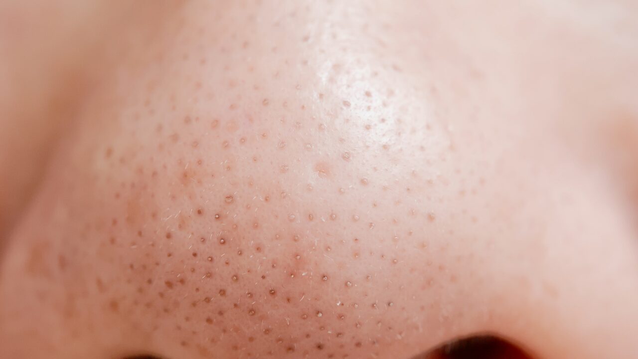 まとめ｜毛穴の悩みは「原因と習慣の見直し」がカギ！