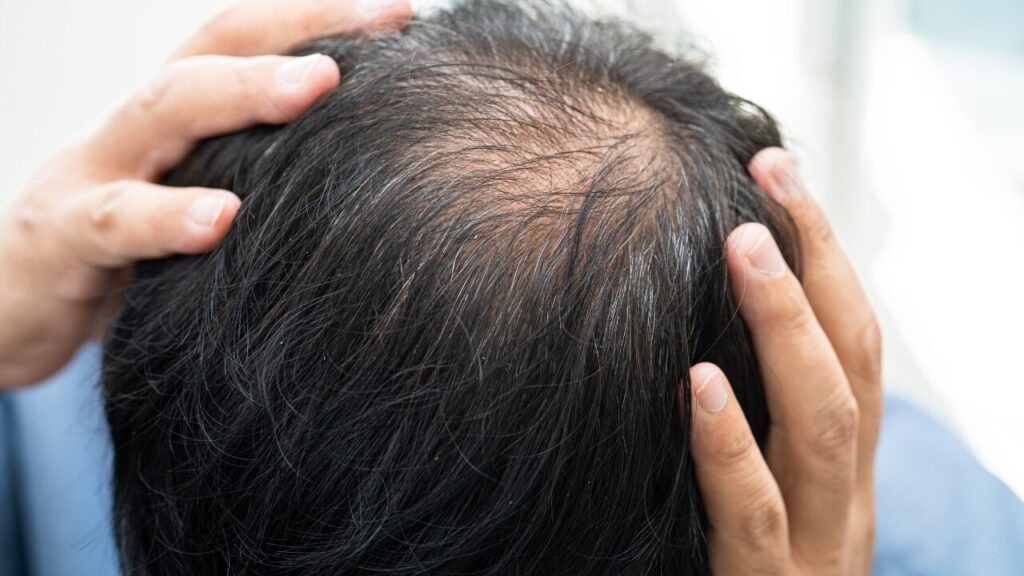 ゴリラクリニックのデメリット・注意点