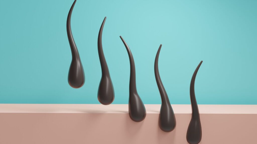 ゴリラクリニックのAGA治療は効果ある？