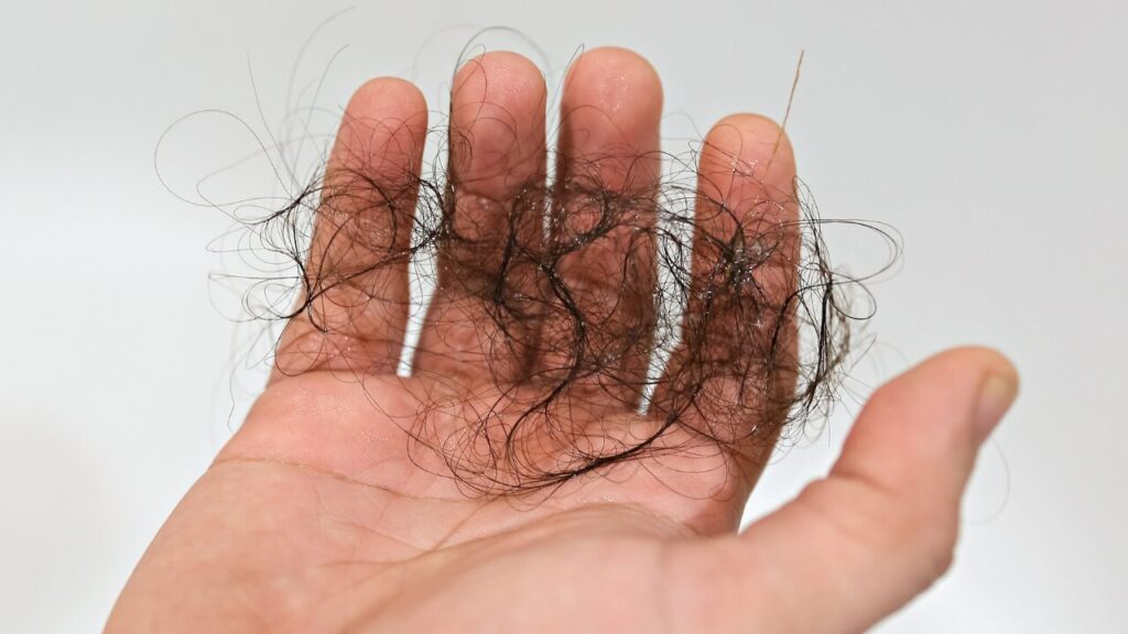 AGA治療が初めての男性に向いている理由