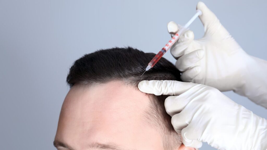 結論｜AGAで悩むなら早く始めるほど効果が出やすい