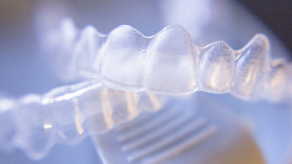 ウィスマイルの強み③|1,650円で“お試し矯正”ができる(30名限定)