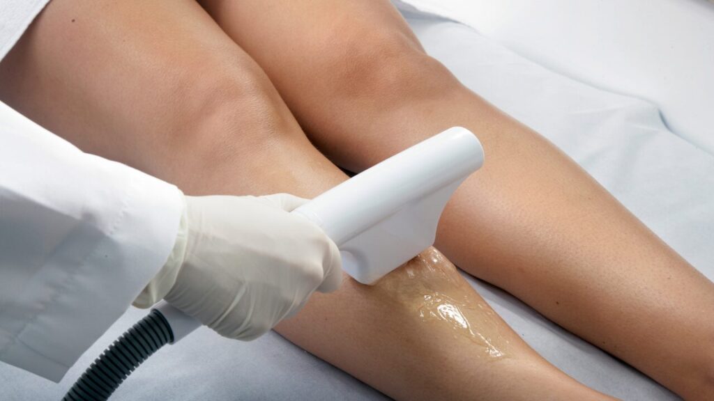 部位別・脱毛スケジュールの立て方【初心者向け】