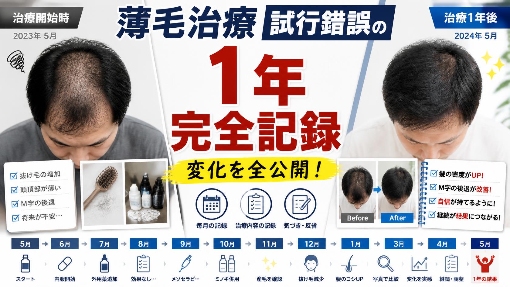 1年間で試した薄毛対策の全記録