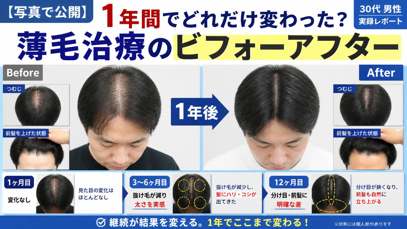 【写真公開】1年間のビフォーアフター比較